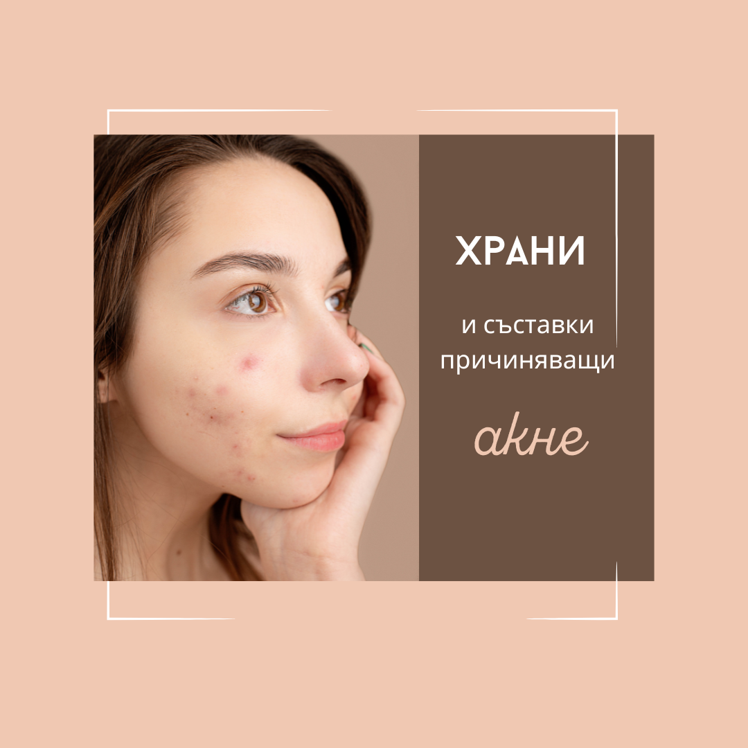 4 храни, които могат да причинят акне